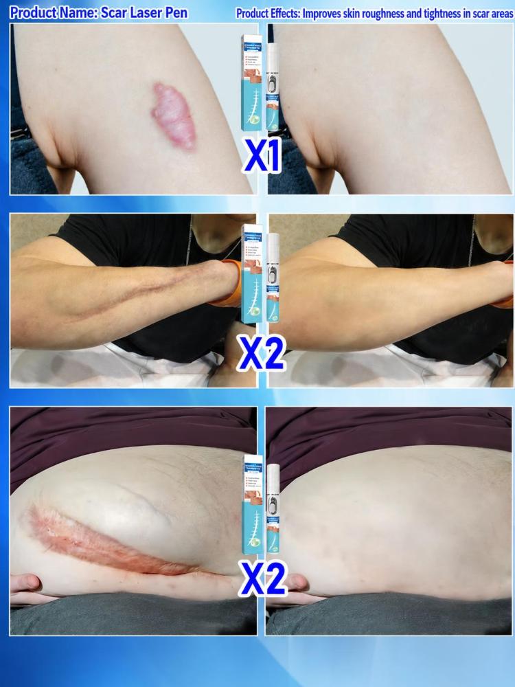 Handheld Skin Beauty Care Devi - Home Improvement Mark 评论和价格
